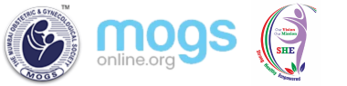 MOGS